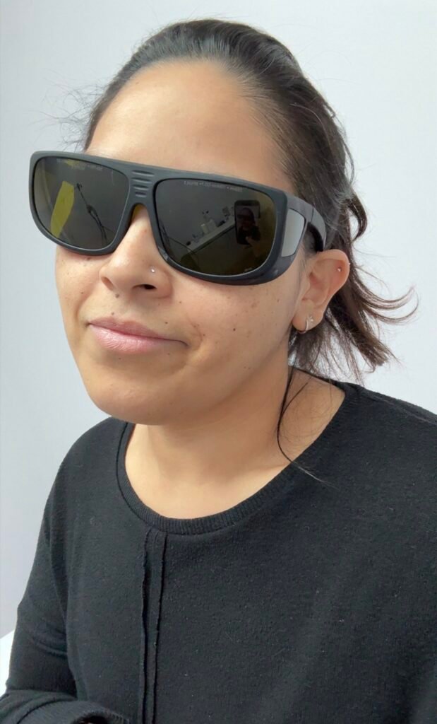My laser hair removal experience.